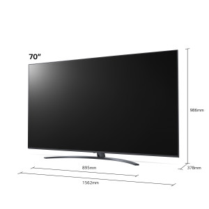 LG UP81 70